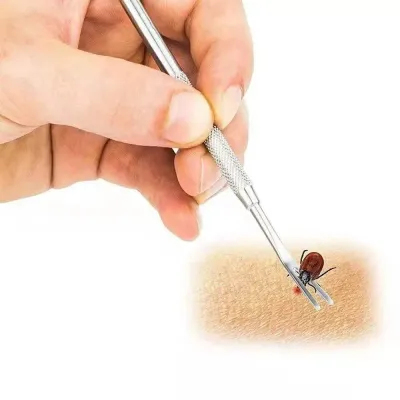 Tick Remover for Cats